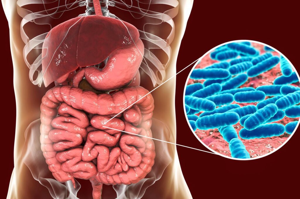 tratamento natural para sibo fitoterapicos ervas saude intestinal
