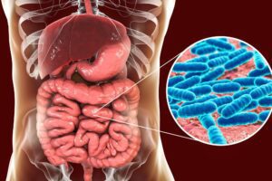tratamento natural para sibo fitoterapicos ervas saude intestinal