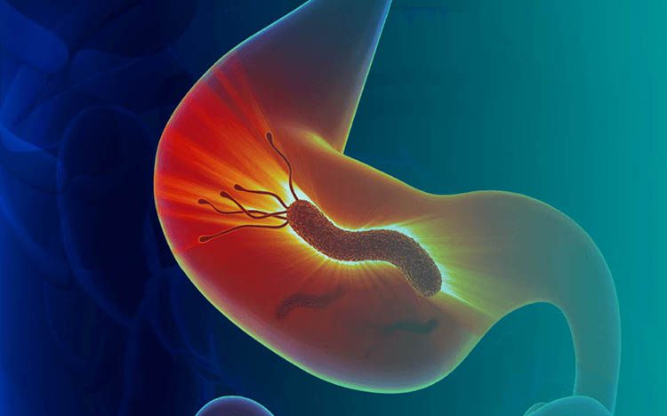 hpylori