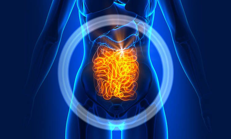 sindrome intestino irritavel